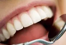 با مصرف این ویتامین‌ ها نگران پوسیدگی دندان‌تان نباشید